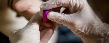 Test auf HIV